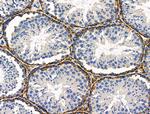 PDX1 Antibody in Immunohistochemistry (Paraffin) (IHC (P))