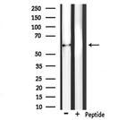 PLAT Antibody in Western Blot (WB)