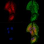 PLAT Antibody in Immunocytochemistry (ICC/IF)