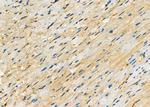 PLAT Antibody in Immunohistochemistry (Paraffin) (IHC (P))