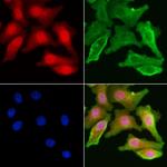 DAP Antibody in Immunocytochemistry (ICC/IF)