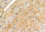 DAP Antibody in Immunohistochemistry (Paraffin) (IHC (P))