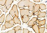 DAP Antibody in Immunohistochemistry (Paraffin) (IHC (P))