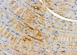 DAP Antibody in Immunohistochemistry (Paraffin) (IHC (P))