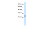 HES7 Antibody in Western Blot (WB)