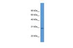 RPIA Antibody in Western Blot (WB)