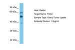 TDO2 Antibody in Western Blot (WB)