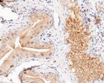 FBP1 Antibody in Immunohistochemistry (Paraffin) (IHC (P))