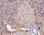 FBP1 Antibody in Immunohistochemistry (Paraffin) (IHC (P))