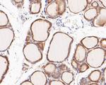 FBP1 Antibody in Immunohistochemistry (Paraffin) (IHC (P))