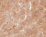 FBP1 Antibody in Immunohistochemistry (Paraffin) (IHC (P))