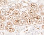 FBP1 Antibody in Immunohistochemistry (Paraffin) (IHC (P))