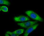 LC3A/LC3B Antibody in Immunocytochemistry (ICC/IF)