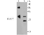 LC3A/LC3B Antibody in Western Blot (WB)