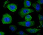 USP21 Antibody in Immunocytochemistry (ICC/IF)