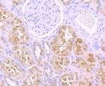 USP21 Antibody in Immunohistochemistry (Paraffin) (IHC (P))