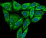 CD266 (TWEAK Receptor) Antibody in Immunocytochemistry (ICC/IF)