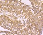 CD266 (TWEAK Receptor) Antibody in Immunohistochemistry (Paraffin) (IHC (P))