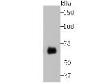 Butyrylcholinesterase Antibody in Western Blot (WB)