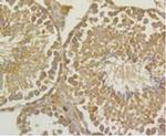 UAP1 Antibody in Immunohistochemistry (Paraffin) (IHC (P))