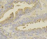 UAP1 Antibody in Immunohistochemistry (Paraffin) (IHC (P))