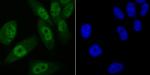 VDR Antibody in Immunocytochemistry (ICC/IF)