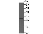 CTDSPL Antibody in Western Blot (WB)