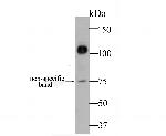 CDH17 Antibody in Western Blot (WB)