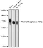 ALPL Antibody in Western Blot (WB)