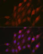 BTRC Antibody in Immunocytochemistry (ICC/IF)