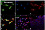 C9orf72 Antibody