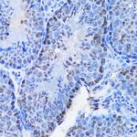 CBX8 Antibody in Immunohistochemistry (Paraffin) (IHC (P))