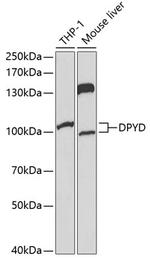 DPYD Antibody in Western Blot (WB)