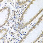 eIF4E Antibody in Immunohistochemistry (Paraffin) (IHC (P))