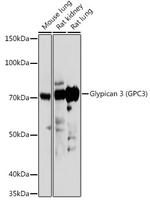 Glypican 3 Antibody in Western Blot (WB)