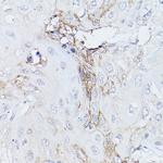 GNA11 Antibody in Immunohistochemistry (Paraffin) (IHC (P))