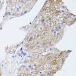 GNA11 Antibody in Immunohistochemistry (Paraffin) (IHC (P))