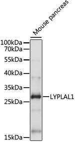 LYPLAL1 Antibody in Western Blot (WB)
