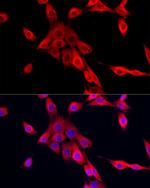 MEIS1 Antibody in Immunocytochemistry (ICC/IF)