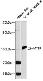 MTTP Antibody in Western Blot (WB)