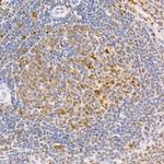 Phospho-SMAD2/SMAD3 (Ser465, Ser467, Ser423, Ser425) Antibody in Immunohistochemistry (Paraffin) (IHC (P))