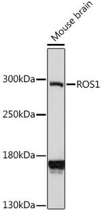 ROS1 Antibody in Western Blot (WB)