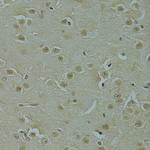 RSRC1 Antibody in Immunohistochemistry (Paraffin) (IHC (P))