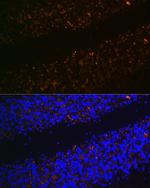 VGLUT2 Antibody in Immunohistochemistry (Paraffin) (IHC (P))