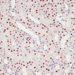 SNRNP70 Antibody in Immunohistochemistry (Paraffin) (IHC (P))