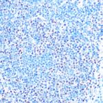 SNRPB Antibody in Immunohistochemistry (Paraffin) (IHC (P))