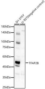TFAP2B Antibody in Western Blot (WB)