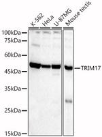 TRIM17 Antibody in Western Blot (WB)