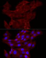 TRIM21 Antibody in Immunocytochemistry (ICC/IF)