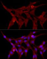 TRIM21 Antibody in Immunocytochemistry (ICC/IF)